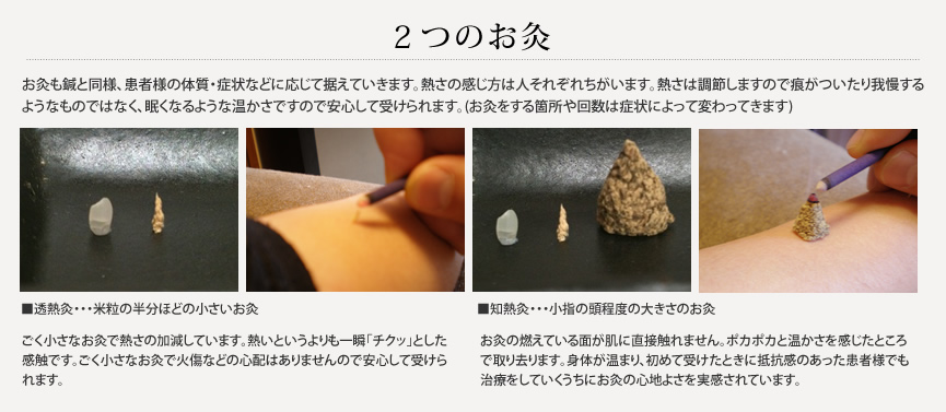 お灸について