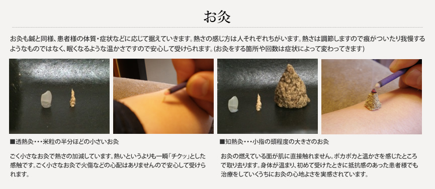 お灸について
